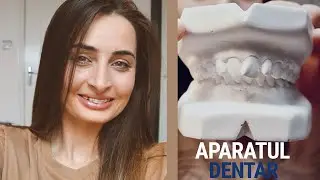 Aparatul dentar din safir/ De ce l-am pus? Cat a costat? Doare?