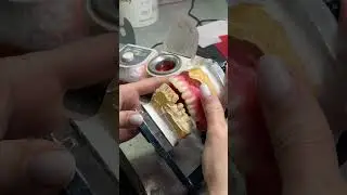 Рабочий процесс 🦷🔥 #dentalprosthesis #доктор #ортодонтическоелечение #пермь #shorts