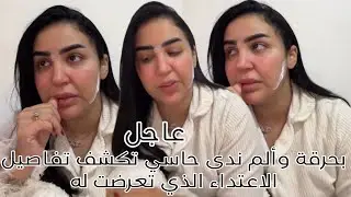 بحرقة وألم ندى حاسي تكشف تفاصيل الاعتداء الذي تعرضت له