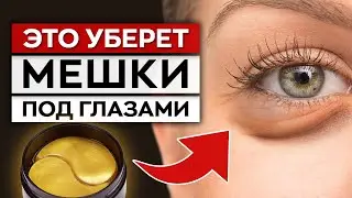 ВСЯ ПРАВДА про патчи! / Помогают ли ПАТЧИ ДЛЯ ЛИЦА избавиться от морщин?