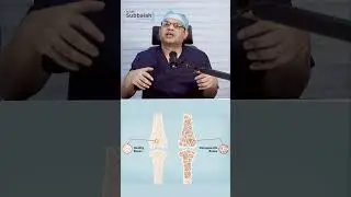 Does menopause cause back pain in telugu | Dr GPV Subbaiah | #menopause #backpain #backpaincauses