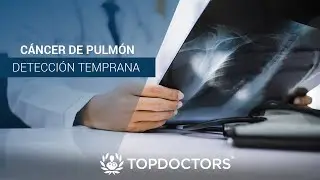 C&aacute;ncer de Pulm&oacute;n &iquest;Qu&eacute; riesgos existen de no tratarse a tiempo?