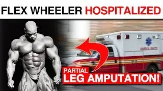 Flex Wheeler Hospitalized - Leg Partially Amputated! | Cardio Confessions