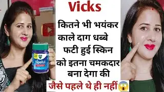 काले दाग,धब्बे, झुर्रियां,स्ट्रेच मार्क्स खत्म हो जाएंगी 7 चमत्कारी फायदे Vicks VapoRub Benefits