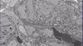 Implanting Human Pluripotent Stem Cell-Derived Kidney Progenitors