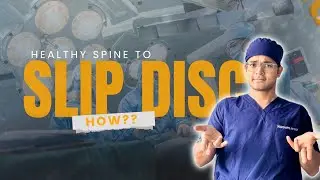 💥 From a Healthy Spine to Slip Disc &ndash; How Does It Happen? | Dr. Siddharth Katkade Explains