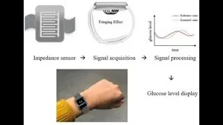 Non Invasive Glucose Monitoring; measure blood sugar levels without finger pricks or blood samples