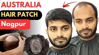 Australia Hair Patch Fixing | Australia Hair Patch In Nagpur | Hair Patch For Men In Nagpur 🔥