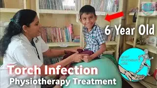 TORCH Infection by Birth | Symptoms & Physiotherapy Treatment | PEMF Therapy | Akshat Physiotherapy