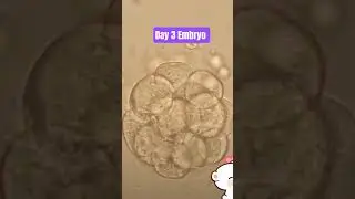 Beautiful cells embryo picture #science #delhiivf #viral #trending #fertilitytreatment #cell#embryo