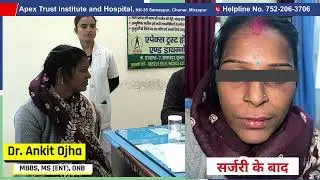 Patient Testimonial | Dr. Ankit Ojha | MBBS, MS (ENT), DNB | Apex Trust Hospital & Diagnostic Chunar