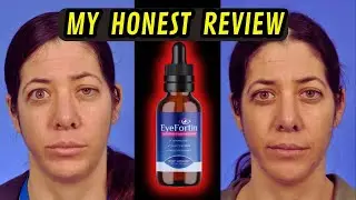 Where to buy Eyefortin | EYEFORTIN PRICE - $49 | Eyefortin Customer Review | Eyefortin honest review