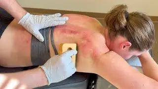 HEALING HIP AND BACK PAIN