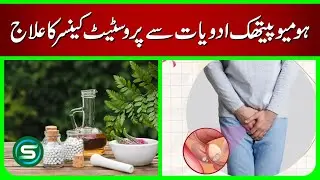 Prostate Cancer Homeopathy Treatment | Best Homeopathic Medicines & Complete Guide