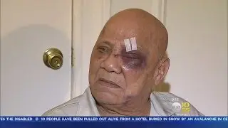 Bronx Man Beaten In His Lobby
