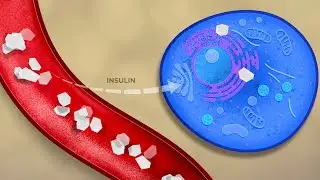 What Is Diabetes (Swahili) - Diabetes Series