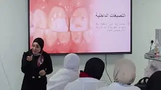 محاضرة بعنوان ( تبييض الأسنان ) للدكتورة زهراء خليل 