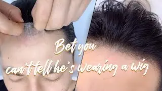 Incredibly UNDETECTABLE Hair System Transformation | Men's Toupee Tricks | Bono Hair