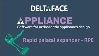 Digital Rapid palatal expander - for 3D printing
