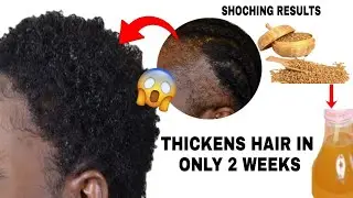 I Got Her To Use This UNBELIEVABLE hair Growth! How to Actually grow your hair fast using Fenugreek