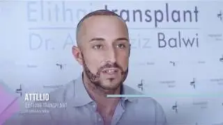 Trapianto di capelli e barba Istanbul - Elithairtransplant