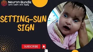 Setting-sun sign | raised intracranial pressure in infants | hydrocephalus #neurology