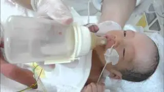 新生児 ミルクのあげ方 生後2日 NICU  35W1D