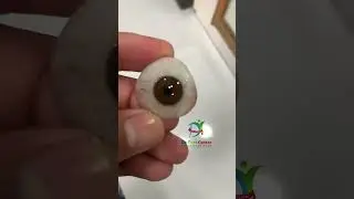 The best 3D customise artificial eye. #artificialeyes #ocularist #prostheticeye #cosmeticsurgery