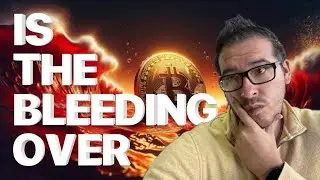 Bitcoin Below $82K &mdash; Panic or Opportunity?