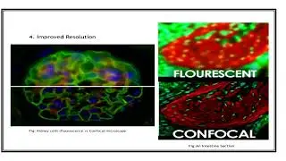 Confocal Microscopy  Video No  1224