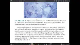 CH21# Maycobacterum