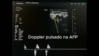 Membro Inferior Direito