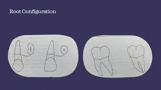 1-Bridge Design part l