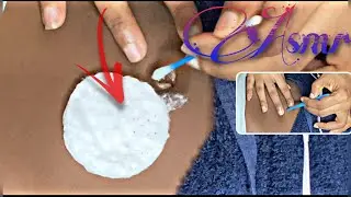 Asmr/ belly/ nitpicking/ brushing/ navel cleaning 😴💤