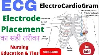 ECG #ElectroCardiaGram #ECG placement, ECG #ChestLead proper way,How to Place ECG electrode/Hindi me