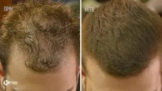 👉HAIRCUT TUTORIAL! Πώς να 