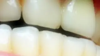 mileshigh - TOOTH ROT ft. WeaselMilk [video]