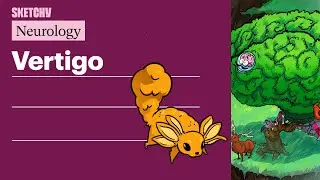 Vertigo: Central vs Peripheral (Neurology) | Sketchy Medical