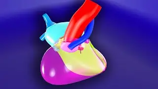 Тетрада Фалло — 3D-анимированная визуальная лекция