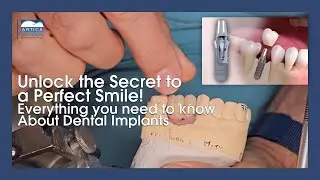 Everything you need to know about Dental Implants in Medellin: Dr. Juan Carlos Mejia
