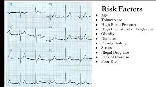 Heart Attack Signs 🚨 | Lifesaving First Aid & CPR