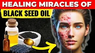 10 Black Seed Oil Benefits (95% of People DON'T Know These Health Benefits of Black Seed Oil)