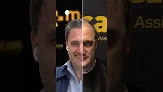Hair Transplant Turkey | MCAN Hair #hairtransplantturkey #hairgoal #hairrestoration