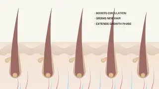 How Light Therapy Works For Hair Growth