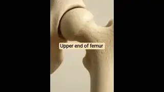 Upper end of Femur✨