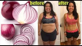 How To Use Onions Juice  For Weight Loss & Reduce Belly Fat in 4  Days