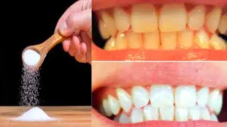 fastest way to deep clean your teeth at home | easy whitening teeth tips