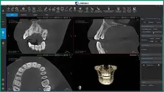 Tomograf stomatologiczny Smart3D-X  - funkcje oprogramowania