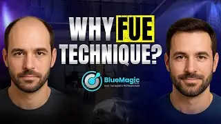 Является ли FUE наиболее распространенной техникой пересадки волос? | BlueMagic Group