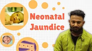 🍼Neonatal Jaundice: Everything You Need to Know |नवजात शिशु में पीलिया के कारण, लक्षण और इलाज 💊